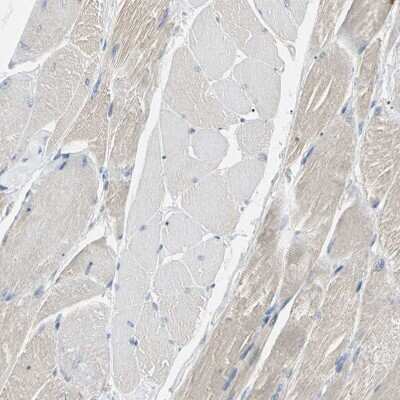 Immunohistochemistry-Paraffin: Testisin/Prss21 Antibody [NBP1-84789] - Staining of human skeletal muscle shows no membranous positivity in myocytes as expected.