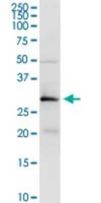 Western Blot: Testisin/Prss21 Antibody [H00010942-D01P] - Analysis of PRSS21 expression in mouse stomach.