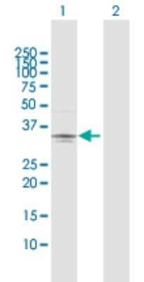 Western Blot: Testisin/Prss21 Antibody [H00010942-D01P] - Analysis of PRSS21 expression in transfected 293T cell line by PRSS21 polyclonal antibody.Lane 1: PRSS21 transfected lysate(34.90 KDa).Lane 2: Non-transfected lysate.