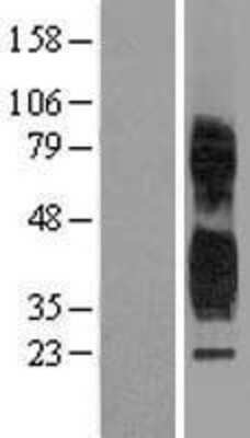 Western Blot: Tetraspanin-1 Overexpression Lysate (Adult Normal) [NBP2-10447] Left-Empty vector transfected control cell lysate (HEK293 cell lysate); Right -Over-expression Lysate for Tetraspanin-1.