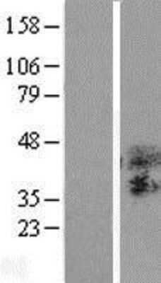 Western Blot: Tetraspanin-3 Overexpression Lysate (Adult Normal) [NBP2-10446] Left-Empty vector transfected control cell lysate (HEK293 cell lysate); Right -Over-expression Lysate for Tetraspanin-3.