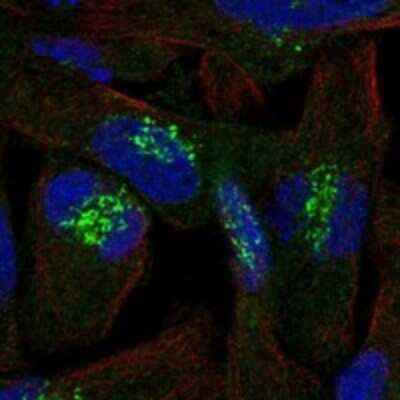 Immunocytochemistry/Immunofluorescence: Tetraspanin-31 Antibody [NBP3-17947] - Staining of human cell line RH-30 shows localization to the Golgi apparatus.