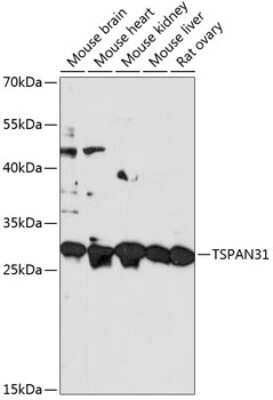 Western Blot: Tetraspanin-31 Antibody [NBP2-93191] - Analysis of extracts of various cell lines, using Tetraspanin-31 at 1:3000 dilution. Secondary antibody: HRP Goat Anti-Rabbit IgG (H+L) at 1:10000 dilution. Lysates/proteins: 25ug per lane. Blocking buffer: 3% nonfat dry milk in TBST. Detection: ECL Basic Kit . Exposure time: 60s.