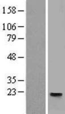 Western Blot: Tetraspanin-31 Overexpression Lysate (Adult Normal) [NBL1-17374] Left-Empty vector transfected control cell lysate (HEK293 cell lysate); Right -Over-expression Lysate for Tetraspanin-31.