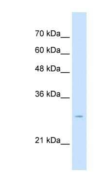 Western Blot: Tetraspanin-32 Antibody [NBP1-62492] - Titration: 2.5ug/ml Positive Control: HepG2 cell lysate.
