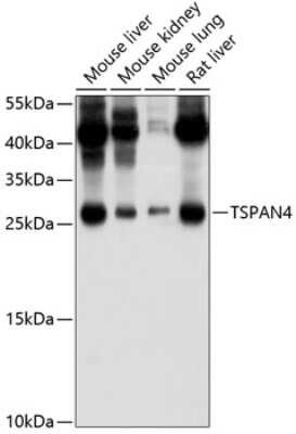 Western Blot: Tetraspanin-4 Antibody [NBP2-93365] - Analysis of extracts of various cell lines, using Tetraspanin-4 at 1:1000 dilution. Secondary antibody: HRP Goat Anti-Rabbit IgG (H+L) at 1:10000 dilution. Lysates/proteins: 25ug per lane. Blocking buffer: 3% nonfat dry milk in TBST. Detection: ECL Basic Kit . Exposure time: 15s.