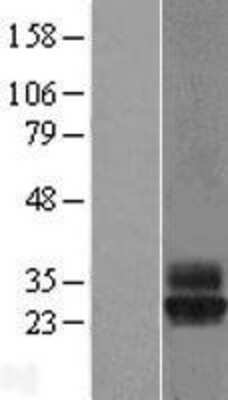 Western Blot: Tetraspanin-4 Overexpression Lysate (Adult Normal) [NBL1-17376] Left-Empty vector transfected control cell lysate (HEK293 cell lysate); Right -Over-expression Lysate for Tetraspanin-4.