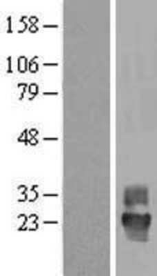 Western Blot: Tetraspanin-4 Overexpression Lysate (Adult Normal) [NBL1-17378] Left-Empty vector transfected control cell lysate (HEK293 cell lysate); Right -Over-expression Lysate for Tetraspanin-4.