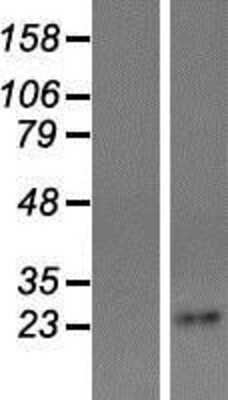 Western Blot: Tetraspanin-4 Overexpression Lysate (Adult Normal) [NBP2-11043] Left-Empty vector transfected control cell lysate (HEK293 cell lysate); Right -Over-expression Lysate for Tetraspanin-4.