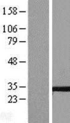 Western Blot: Tetraspanin-5 Overexpression Lysate (Adult Normal) [NBL1-17379] Left-Empty vector transfected control cell lysate (HEK293 cell lysate); Right -Over-expression Lysate for Tetraspanin-5.
