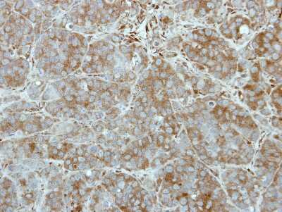 Immunohistochemistry-Paraffin Tex14 Antibody - BSA Free