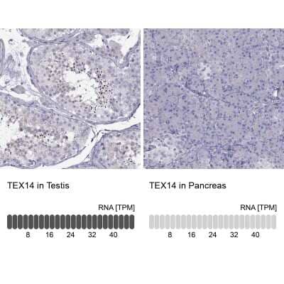 Immunohistochemistry-Paraffin Tex14 Antibody