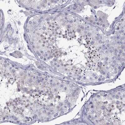 Immunohistochemistry-Paraffin Tex14 Antibody