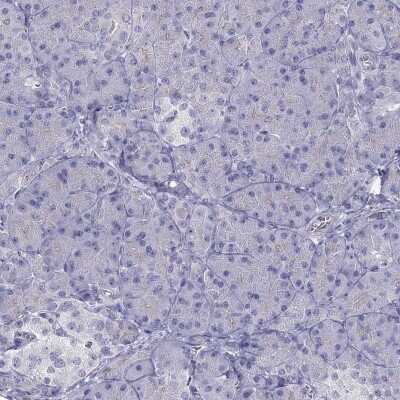 Immunohistochemistry-Paraffin Tex14 Antibody