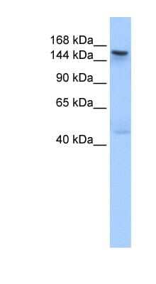 Western Blot: Tex14 Antibody [NBP1-54999] - Human Muscle lysate, concentration 0.2-1 ug/ml.