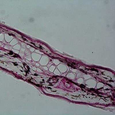 Immunohistochemistry-Frozen: TfR (Transferrin R) Antibody (ER-MP21) [NBP1-51810] - IHC-F using this antibody.