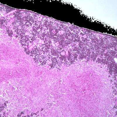 Immunohistochemistry-Frozen: TfR (Transferrin R) Antibody (ER-MP21) [NBP1-51810] - IHC-F using this antibody.