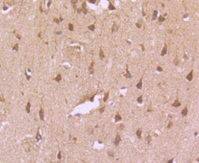 Immunohistochemistry-Paraffin: TfR (Transferrin R) Antibody (JF0956) [NBP2-67189] - Analysis of paraffin-embedded rat brain tissue using anti-Transferrin Receptor antibody. Counter stained with hematoxylin.