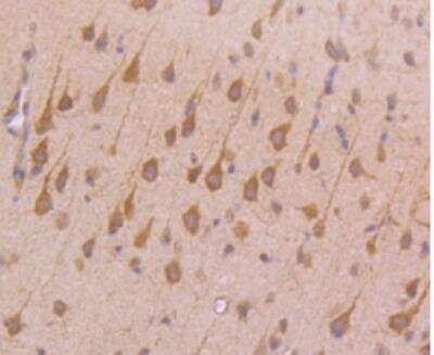 Immunohistochemistry-Paraffin: TfR (Transferrin R) Antibody (JF0956) [NBP2-67189] - Analysis of paraffin-embedded mouse brain tissue using anti-Transferrin Receptor antibody. Counter stained with hematoxylin.