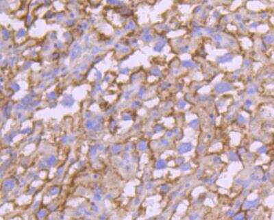 Immunohistochemistry-Paraffin: TfR (Transferrin R) Antibody (JF0956) [NBP2-67189] - Analysis of paraffin-embedded mouse placenta tissue using anti-Transferrin Receptor antibody. Counter stained with hematoxylin.