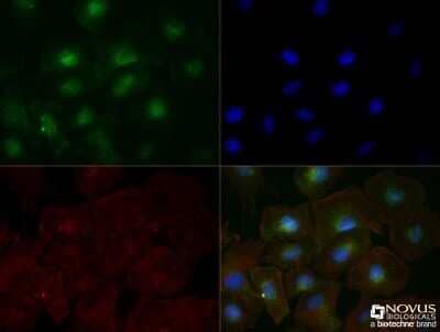 Immunocytochemistry/Immunofluorescence: TfR (Transferrin R) Antibody (OX26) - Azide and BSA Free [NBP2-80976] - PC-12 cells were fixed for 10 minutes using 10% formalin and then permeabilized for 5 minutes using 1X TBS + 0.5% Triton X-100. The cells were incubated with anti TfR/Transferrin R (OX26) NB200-585 at a 1:100 dilution overnight at 4C and detected with an anti-mouse DyLight 488 (green) at a 1:500 dilution. Actin was detected with Phalloidin 568 (red) at a 1:200 dilution. Nuclei were counterstained with DAPI (blue). Cells were imaged using a 40X objective. Image from the standard format of this antibody.