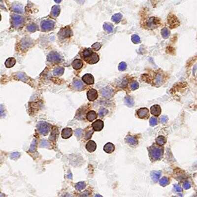 Immunohistochemistry-Paraffin: TfR (Transferrin R) Antibody (OX26) - Azide and BSA Free [NBP2-80976] - Analysis of FFPE mouse spleen using TfR (OX26) antibody at 1:50 on a Bond Rx autostainer (Leica Biosystems). The assay involved 20 minutes of heat induced antigen retrieval (HIER) using 10mM sodium citrate buffer (pH 6.0) and endogenous peroxidase quenchi