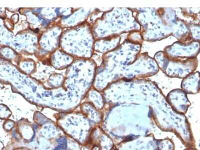 Immunohistochemistry-Paraffin: TfR (Transferrin R) Antibody (TFRC/1818) [NBP2-53283] - Formalin-fixed, paraffin-embedded Human Placenta stained with CD71 Monoclonal Antibody (TFRC/1818).