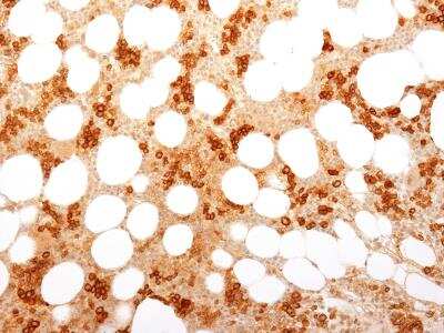 Immunohistochemistry-Paraffin: TfR (Transferrin R) Antibody (TFRC/1818) [NBP2-53283] - Formalin-fixed, paraffin-embedded Human Bone Marrow stained