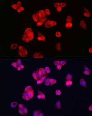 Immunocytochemistry/Immunofluorescence: TfR2 Antibody [NBP2-93436] - Immunofluorescence analysis of HepG2 cells using TfR2 Rabbit pAb (NBP2-93436) at dilution of 1:100 (40x lens). Blue: DAPI for nuclear staining.