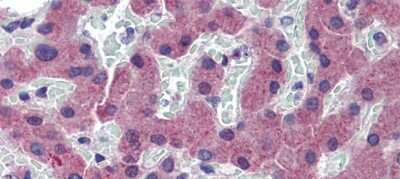 Immunohistochemistry: TfR2 Antibody [NBP2-86864] - Human Skin