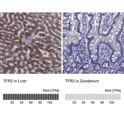 Immunohistochemistry-Paraffin: TfR2 Antibody [NBP3-17003] - Analysis in human liver and duodenum tissues using Anti-TFR2 antibody. Corresponding TFR2 RNA-seq data are presented for the same tissues.