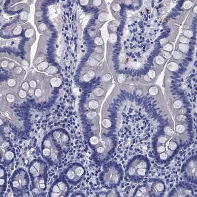 Immunohistochemistry-Paraffin: TfR2 Antibody [NBP3-17003] - Staining of human duodenum shows low expression as expected.