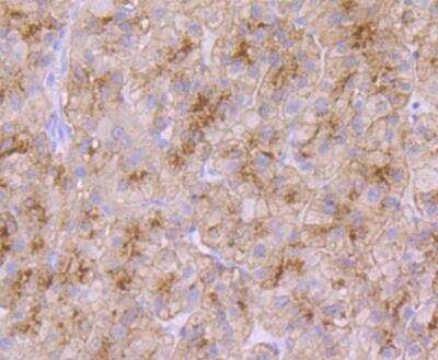 Immunohistochemistry-Paraffin: TfR2 Antibody (JG58-34) [NBP2-89122] - Analysis of paraffin-embedded human liver tissue using anti-Transferrin Receptor 2 antibody. Counter stained with hematoxylin.