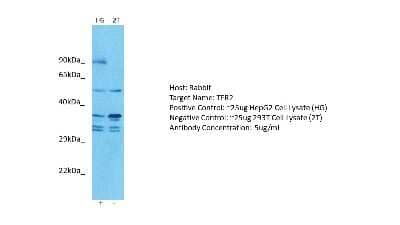 Western Blot: TfR2 Antibody [NBP2-86864] - Host: Rabbit. Target: TFR2. Positive control (+): HepG2 Cell Lysate (HG). Negative control (-): 293T Cell Lysate (2T). Antibody concentration: 5ug/ml