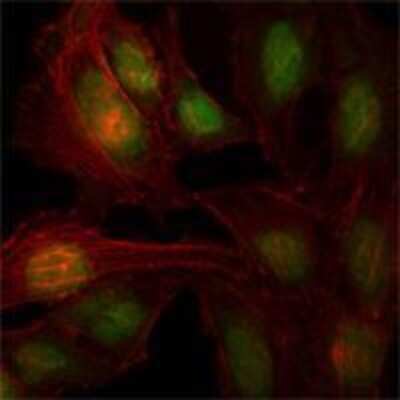 Immunocytochemistry/Immunofluorescence: Th-POK Antibody (7C12) [NBP1-42564] - analysis of Hela cells using ZBTB7B mouse mAb (green). Red: Actin filaments have been labeled with Alexa Fluor-555 phalloidin.