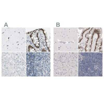 Immunohistochemistry-Paraffin: Th-POK Antibody [NBP1-88077] - Staining of human cerebral cortex, colon, liver and lymph node using Anti-ZBTB7B antibody NBP1-88077 (A) shows similar protein distribution across tissues to independent antibody NBP1-88078 (B).
