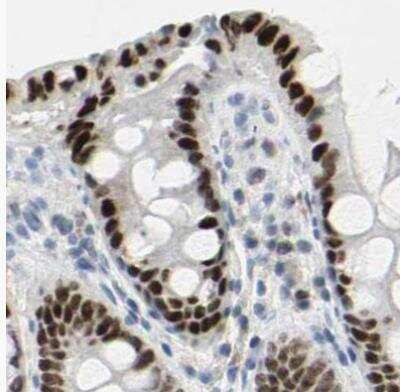 Immunohistochemistry-Paraffin: Th-POK Antibody [NBP1-88077] - Staining of human colon using Anti-ZBTB7B antibody.