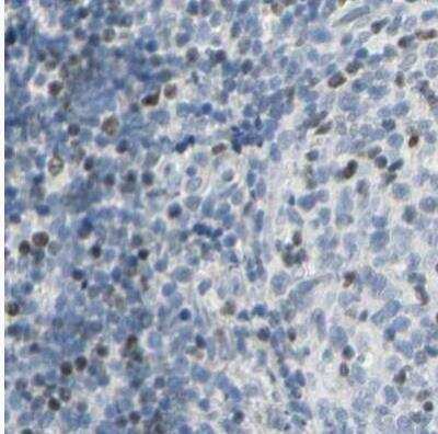 Immunohistochemistry-Paraffin: Th-POK Antibody [NBP1-88077] - Staining of human lymph node using Anti-ZBTB7B antibody.