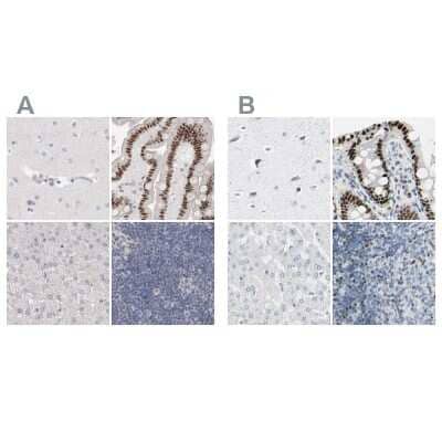 <b>Independent Antibodies Validation and Orthogonal Strategies Validation.</b>Immunohistochemistry-Paraffin: Th-POK Antibody [NBP1-88078] - Staining of human cerebral cortex, colon, liver and lymph node using Anti-ZBTB7B antibody NBP1-88078 (A) shows similar protein distribution across tissues to independent antibody NBP1-88077 (B).