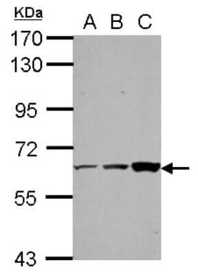 Western Blot: ThPok Antibody [NBP2-20623] - Sample (30 ug of whole cell lysate) A: 293T B: HeLa C: HepG2 7. 5% SDS PAGE gel, diluted at 1:1000.