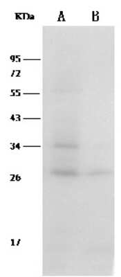 Western Blot: Thioredoxin-1 Antibody (002) [NBP2-90730] - Anti-Txn rabbit monoclonal antibody at 1:500 dilution. Lane A: Hela Whole Cell Lysate. Lane B: A431 Whole Cell Lysate. Lysates/proteins at 30 ug per lane. Secondary: Goat Anti-Rabbit IgG (H+L)/HRP at 1/10000 dilution. Developed using the ECL technique. Performed under reducing conditions. Predicted band size:27 kDa. Observed band size:27 kDa