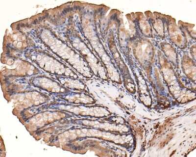 Immunohistochemistry-Paraffin: Thioredoxin-1 Antibody (JF101-8) [NBP2-67195] - Analysis of paraffin-embedded rat big intestine tissue with Rabbit anti-Thioredoxin-1 antibody washed with ddH2O and PBS, and then probed with the primary antibody  at 1/400 dilution for 1 hour at room temperature. The detection was performed using an HRP conjugated compact polymer system. DAB was used as the chromogen. Tissues were counterstained with hematoxylin and mounted with DPX.