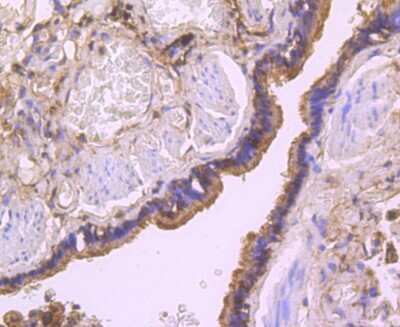 Immunohistochemistry-Paraffin: Thioredoxin-1 Antibody (JM10-019) [NBP2-67198] - Analysis of paraffin-embedded human lung tissue using anti-TRX1 antibody. Counter stained with hematoxylin.