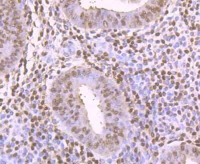 Immunohistochemistry-Paraffin: Thioredoxin-1 Antibody (JM10-019) [NBP2-67198] - Analysis of paraffin-embedded human uterus tissue using anti-TRX1 antibody. Counter stained with hematoxylin.