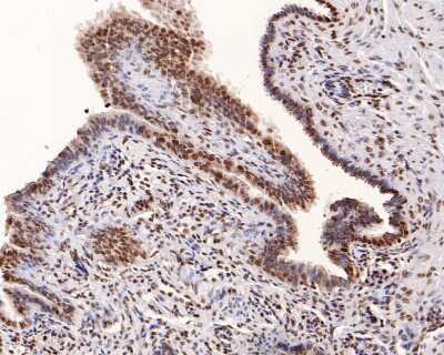 Immunohistochemistry-Paraffin: Thioredoxin-1 Antibody (JM10-019) [NBP2-67198] - Analysis of paraffin-embedded human fallopian tube tissue with Rabbit anti-Thioredoxin-1 antibody. The section was pre-treated using heat mediated antigen retrieval with sodium citrate buffer (pH 6.0) for 2 minutes. The tissues were blocked in 1% BSA for 20 minutes at room temperature, washed with ddH2O and PBS, and then probed with the primary antibody for 1 hour at room temperature. The detection was performed using an HRP conjugated compact polymer system. DAB was used as the chromogen. Tissues were counterstained with hematoxylin and mounted with DPX.