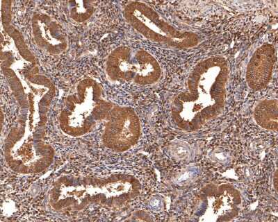Immunohistochemistry-Paraffin: Thioredoxin-1 Antibody (JM10-019) [NBP2-67198] - Analysis of paraffin-embedded human uterus tissue with Rabbit anti-Thioredoxin-1 antibody washed with ddH2O and PBS, and then probed with the primary antibody  at 1/400 dilution for 1 hour at room temperature. The detection was performed using an HRP conjugated compact polymer system. DAB was used as the chromogen. Tissues were counterstained with hematoxylin and mounted with DPX.