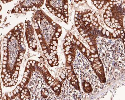 Immunohistochemistry-Paraffin: Thioredoxin-1 Antibody (JM10-019) [NBP2-67198] - Analysis of paraffin-embedded human small intestine tissue with Rabbit anti-Thioredoxin-1 antibody. The section was pre-treated using heat mediated antigen retrieval with sodium citrate buffer (pH 6.0) for 2 minutes. The tissues were blocked in 1% BSA for 20 minutes at room temperature, washed with ddH2O and PBS, and then probed with the primary antibody for 1 hour at room temperature. The detection was performed using an HRP conjugated compact polymer system. DAB was used as the chromogen. Tissues were counterstained with hematoxylin and mounted with DPX.