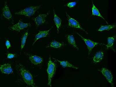 Immunocytochemistry/Immunofluorescence: Thioredoxin-2 Antibody [NBP3-00013] - Immunofluorescence staining of Thioredoxin-2 in HELA cells. Cells were fixed with 4% PFA, permeabilzed with 0.1% Triton X-100 in PBS, blocked with 10% serum, and incubated with rabbit anti-Human Thioredoxin-2 polyclonal antibody (dilution ratio 1:1000) at 4C overnight. Then cells were stained with the Alexa Fluor(R)488-conjugated Goat Anti-rabbit IgG Secondary antibody (green) and counterstained with DAPI (blue).Positive staining was localized to Cytoplasm.