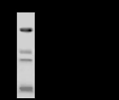 Immunoprecipitation: Thioredoxin-2 Antibody [NBP3-00013] - Thioredoxin-2 was immunoprecipitated using: Lane A: 0.5 mg A431 Whole Cell Lysate. 4 ul anti-Thioredoxin-2 rabbit polyclonal antibody and 60 ug of Immunomagnetic beads. Protein A/G. Primary antibody: Anti-Thioredoxin-2 rabbit polyclonal antibody, at 1:100 dilution. Secondary antibody: Clean-Blot IP Detection Reagent (HRP) at 1:1000 dilution. Developed using the ECL technique. Performed under reducing conditions. Predicted band size: 48 kDa. Observed band size: 43 kDa