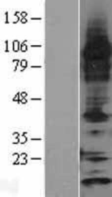 Western Blot: Thioredoxin 2 Overexpression Lysate (Adult Normal) [NBP2-04338] Left-Empty vector transfected control cell lysate (HEK293 cell lysate); Right -Over-expression Lysate for Thioredoxin 2.